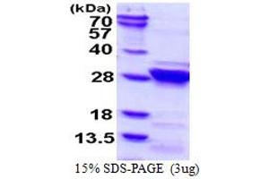 SDS-PAGE (SDS) image for Regulator of G-Protein Signaling 4 (RGS4) (AA 1-205) protein (His tag) (ABIN7529178) (RGS4 Protein (AA 1-205) (His tag))