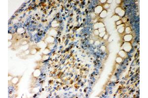 Anti- STIM1 Picoband antibody, IHC(P) IHC(P): Rat Intestine Tissue