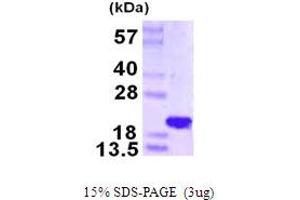 SDS-PAGE (SDS) image for N(alpha)-Acetyltransferase 50, NatE Catalytic Subunit (NAA50) (AA 1-169) protein (His tag) (ABIN667671)