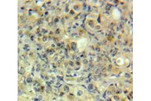 Used in DAB staining on fromalin fixed paraffin-embedded Ovary tissue (GRK5 antibody  (AA 304-532))