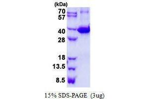 Figure annotation denotes ug of protein loaded and % gel used. (Galectin 9 Protein)