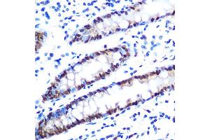 Immunohistochemistry (IHC) image for anti-Heterogeneous Nuclear Ribonucleoprotein A1 (HNRNPA1) antibody (ABIN7267627)