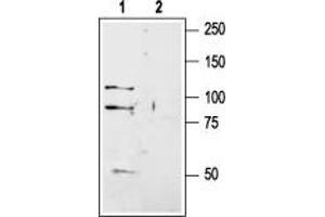 GRIK1 anticorps  (Extracellular, N-Term)