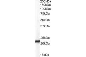 Western Blotting (WB) image for anti-Chromosome 15 Open Reading Frame 26 (C15orf26) (Middle Region) antibody (ABIN2785319) (C15orf26/CFAP161 antibody  (Middle Region))