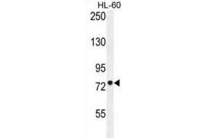 Western Blotting (WB) image for anti-Carnitine Palmitoyltransferase 1C (CPT1C) antibody (ABIN2996207) (CPT1C antibody)
