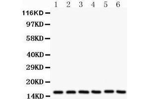 Western Blotting (WB) image for anti-Superoxide Dismutase 1, Soluble (SOD1) (AA 116-146), (C-Term) antibody (ABIN3043438) (SOD1 antibody  (C-Term))