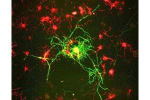 Immunostaining of cultured rat neurons showing labeling of NF-M (green) in mature neurons. (NEFM antibody  (C-Term))