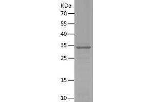 Western Blotting (WB) image for Sarcoglycan, epsilon (SGCE) (AA 15-127) protein (His-IF2DI Tag) (ABIN7283634) (SGCE Protein (AA 15-127) (His-IF2DI Tag))