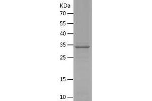 SGCE Protein (AA 15-127) (His-IF2DI Tag)