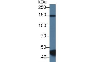 Detection of RBM20 in Porcine Skeletal muscle lysate using Polyclonal Antibody to RNA Binding Motif Protein 20 (RBM20) (RBM20 antibody  (AA 1089-1227))