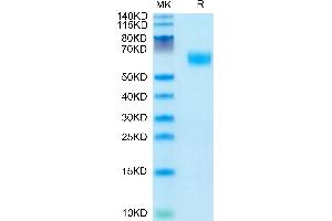 Mouse AMIGO2 on Tris-Bis PAGE under reduced condition. (AMIGO2 Protein (AA 39-397) (His tag))