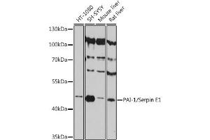 Western blot analysis of extracts of various cell lines, using PAI-1/Serpin E1 antibody (ABIN6131329, ABIN6147600, ABIN6147602 and ABIN6215676) at 1:3000 dilution. (PAI1 antibody  (AA 24-158))