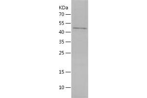 Western Blotting (WB) image for Hepatocyte Growth Factor (Hepapoietin A, Scatter Factor) (HGF) (AA 493-721) protein (His-IF2DI Tag) (ABIN7123304) (HGF Protein (AA 493-721) (His-IF2DI Tag))