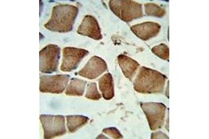 Formalin-fixed and paraffin-embedded human skeletal muscle reacted with DIPA Antibody , which was peroxidase-conjugated to the secondary antibody, followed by DAB staining. (CCDC85B antibody  (Middle Region))