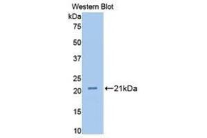 Western Blotting (WB) image for anti-Fibulin 1 (FBLN1) (AA 347-521) antibody (ABIN1175708) (Fibulin 1 antibody  (AA 347-521))