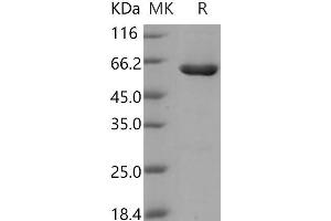 Western Blotting (WB) image for Casein Kinase 2, alpha Prime Polypeptide (CSNK2A2) (Active) protein (GST tag,His tag) (ABIN7317080) (CSNK2A2 Protein (GST tag,His tag))