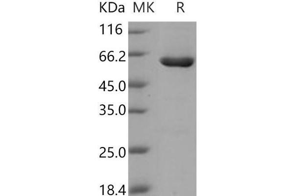 CSNK2A2 Protein (GST tag,His tag)
