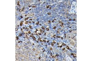 Immunohistochemistry of paraffin-embedded rat spleen using FA Rabbit pAb (ABIN7267102) at dilution of 1:100 (40x lens). (FAM117A antibody)