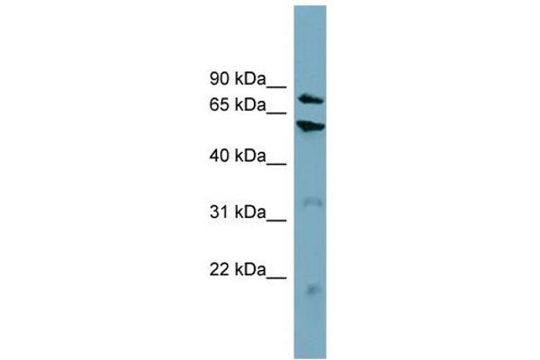 CPT1B antibody  (Middle Region)