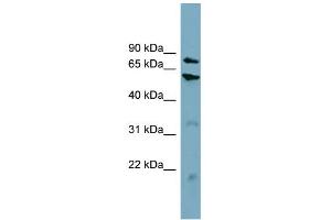 WB Suggested Anti-CPT1B Antibody Titration:  0. (CPT1B antibody  (Middle Region))