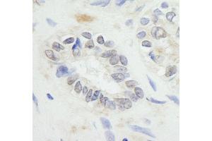 Immunohistochemistry (IHC) image for anti-Ring Finger Protein 20 (RNF20) (AA 125-175) antibody (ABIN7448779)