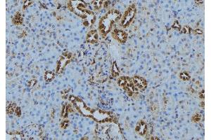 ABIN6272870 at 1/100 staining Mouse kidney tissue by IHC-P. (IFT140 antibody  (Internal Region))