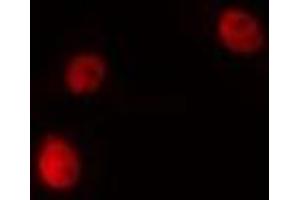 ABIN6275196 staining HeLa cells by IF/ICC. (NKX2-6 antibody  (Internal Region))