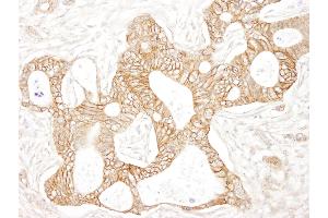 Immunohistochemistry (IHC) image for anti-Catenin, beta (CATNB) (AA 760-781) antibody (ABIN7448432) (beta Catenin antibody  (AA 760-781))