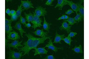 Immunofluorescence anti-CLTC Ab Membrane Vesicle Marker in Hepa1-6 Cells at 1/50 dilution, Cells were fixed With methanol,