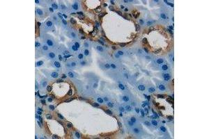 Immunohistochemical analysis of GSTT1 staining in human kidney formalin fixed paraffin embedded tissue section. (GSTT1 antibody)