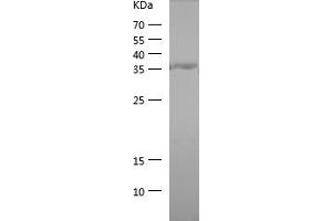 Western Blotting (WB) image for Protein tyrosine Phosphatase, Non-Receptor Type 1 (PTPN1) (AA 268-406) protein (His tag) (ABIN7124680) (PTPN1 Protein (AA 268-406) (His tag))