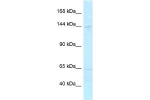 WB Suggested Anti-MYBBP1A Antibody Titration: 1. (MYBBP1A antibody  (C-Term))