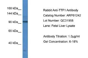 Western Blotting (WB) image for anti-Transcription Termination Factor, RNA Polymerase I (TTF1) (Middle Region) antibody (ABIN2788733) (TTF1 antibody  (Middle Region))