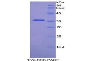 SDS-PAGE analysis of Rat NEK2 Protein. (NEK2 Protein)