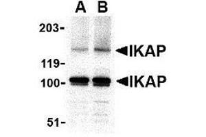 Western blot analysis of IKAP in A-20 cell lysate with AP30402PU-N IKAP antibody at in (A) 0.