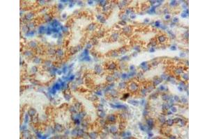 #VALUE! (CYP11B1 antibody  (AA 1-498))