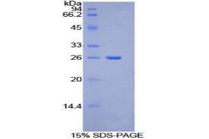 SDS-PAGE (SDS) image for Torsin Family 2, Member A (TOR2A) (AA 125-313) protein (His tag) (ABIN2127028)