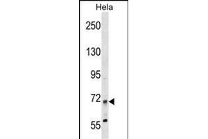 MTMR14 Antibody (N-term) (ABIN1539114 and ABIN2849079) western blot analysis in Hela cell line lysates (35 μg/lane). (MTMR14 antibody  (N-Term))