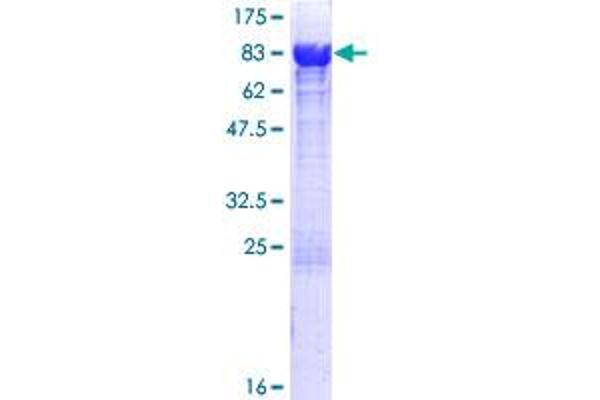 ATIC Protein (AA 1-592) (GST tag)