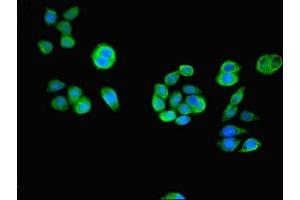 Immunofluorescent analysis of PC-3 cells using ABIN7166648 at dilution of 1:100 and Alexa Fluor 488-congugated AffiniPure Goat Anti-Rabbit IgG(H+L) (ACOT6 antibody  (AA 1-207))
