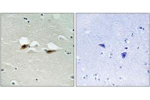 Immunohistochemistry analysis of paraffin-embedded human brain, using ATF-2 (Phospho-Ser472) Antibody. (ATF2 antibody  (pSer472))