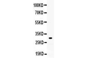 Western blot analysis of ZWINT expression in rat skeletal muscle extract ( Lane 1). (ZWINT antibody  (AA 29-249))