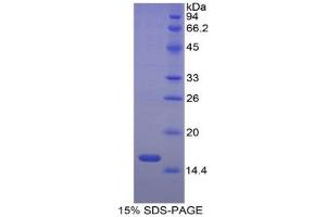 SDS-PAGE analysis of Cow ACVR2A Protein. (ACVR2A Protein)