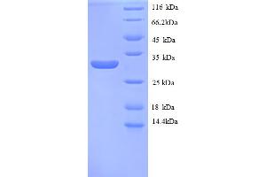 SDS-PAGE (SDS) image for Metallothionein 1E (MT1E) (AA 4-59), (partial) protein (GST tag) (ABIN5713084)
