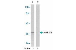 Western blot analysis of extracts from MDA-MB-435 cells using MAP2K6 polyclonal antibody . (MAP2K6 antibody  (Ser207))
