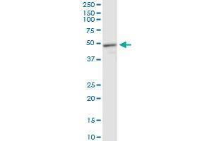 MECP2 monoclonal antibody (M01), clone 4B6. (MECP2 antibody  (AA 81-170))