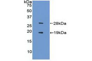 Western blot analysis of recombinant Mouse FCN1. (SIRT1 antibody  (AA 244-498))