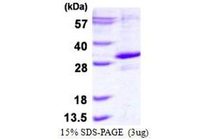 Image no. 1 for Egl-9 Family Hypoxia Inducible Factor 3 (EGLN3) protein (His tag) (ABIN6386986) (EGLN3 Protein (His tag))