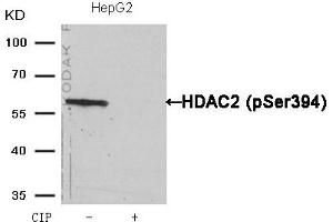Western blot analysis of extracts from HepG2 cells, treated with calf intestinal phosphatase (CIP), using HDAC2 (Phospho-Ser394) Antibody.