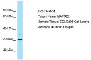 Image no. 1 for anti-Microtubule-Associated Protein, RP/EB Family, Member 2 (MAPRE2) (AA 157-206) antibody (ABIN6750058)
